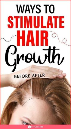 Natural Hair Oil, Faster Hair Growth, Hair Growth Secrets, Hair Growing Tips, New Hair Growth, Growth Hair, Mega Hair