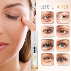 Eye Bags Makeup, Remove Eye Bags, Instant Face Lift, Under Eye Wrinkles, Dark Circles Under Eyes, Reduce Dark Circles, Face Wrinkles, Delicious Snacks, Eye Wrinkle