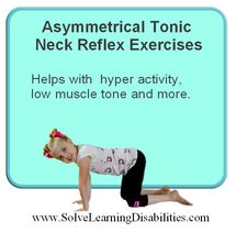 Asymmetrical Tonic Neck Reflex Exercises Low Muscle Tone, Vision Therapy