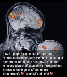 an x - ray image with the words i love science this is the first mri of a mother kissing her baby