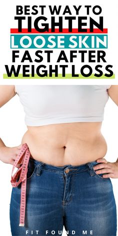 How to tighten loose skin after weight loss without a face lift or surgery. I use this everyday...surprised at the benefits...still use it years later. Loose Skin On Stomach, Tighten Loose Skin, Decrease Weight, Tighten Skin, Health Trends, Lower Belly, Face Lift, Loose Skin, Sagging Skin