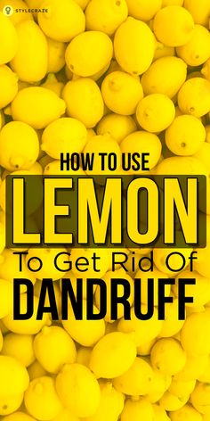 How To Remove Dandruff, Natural Hair Removal Remedies, Dandruff Solutions, Home Remedies For Dandruff, Rid Of Dandruff, Hair Lifestyle, Lemon Hair, Stop Hair Breakage, Healing Techniques