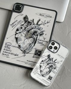 an iphone case with a drawing on it next to a cell phone and laptop computer