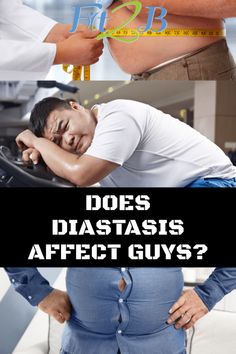 a man with his stomach exposed and the words does diastasis affects after guys?