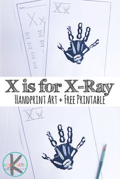 four handprint art and free printables for x is for x - ray