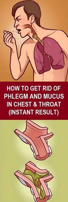 Mucus In Chest, Congestion Remedies, Chest Congestion, Health Planner, Cold Remedies, Yoga Sequences, Health Skin Care, Healthy Ideas