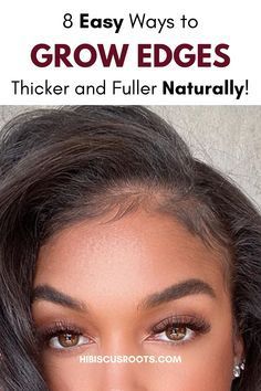 Growing Edges Back, Edges On Natural Hair, How To Grow Edges, Regrow Hairline, Grow Baby Hair, Regrow Edges, Grow Edges, Grow Hair Back, Thinning Hairline