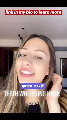 Braces Tips, Teeth Whitening Homemade, Diy Skin Care Routine, Beauty Routine Tips, Natural Teeth Whitening, Whitening Kit, Teeth Care