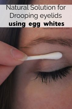 Saggy Eyelids, Sagging Eyelids, Drooping Eyelids, Hooded Eyelids, Droopy Eyelids, Droopy Eyes, Natural Healing Remedies, Diy Remedies, Leaky Gut