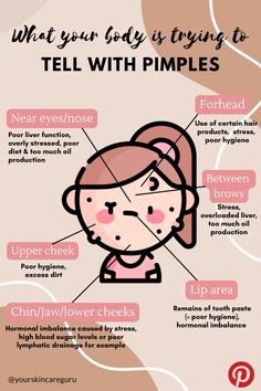 Why You Get Acne In Certain Areas, What Do Your Pimples Mean, Pimples Reasons Faces, Causes Of Pimples On Face, Placement Of Pimples Meaning, Pimple Face Guide, What Pimples In Different Places Means, Reasons Of Pimples On Face, Reasons For Pimples On Face