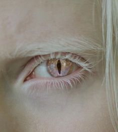 a woman's eye with gold colored contactions on the outside of her iris