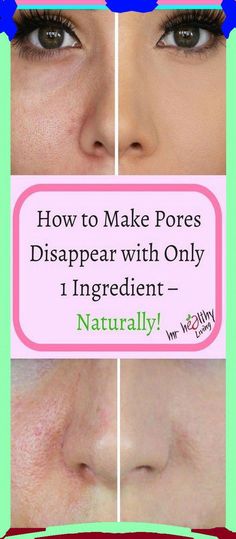 top 9 Open Pores On Face, Smooth Skin Face, Pores On Face, Skin Care Procedures, Big Pores, Lotion For Oily Skin, Face Pores, Clear Skin Face