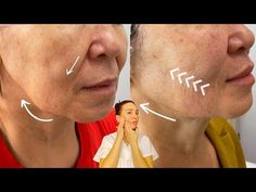 Saggy Cheeks, Face Lifting Massage, Saggy Jowls, Saggy Face, Graceful Aging, Sagging Cheeks, Sagging Face, Facial Routine Skincare, Drainage Massage