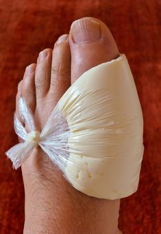 Ugly Toenails, Landscaping Simple, Chicken Thigh Recipes Crockpot, Boneless Chicken Thigh Recipes, Chicken Thigh Recipes Baked, Uric Acid, Baked Chicken Thighs, Dandelion Recipes, Knitting Machine Projects