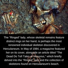 an image of a skeleton with the caption'the ringed lady, whose skeletal remains feature