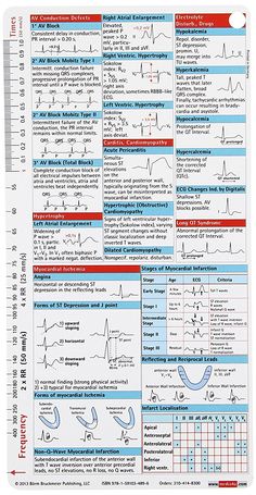 a poster with instructions on how to use an electrocard for the patient's heart rate