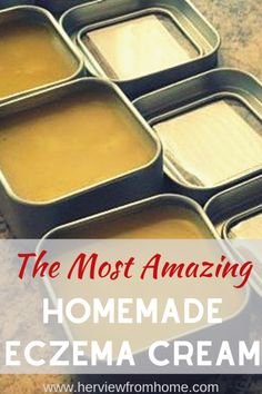 Salve Recipes, Healing Salves, Homemade Lotion, Eye Creams, Homemade Bath Products, Homemade Soap, Lotion Bars, Skin Care Recipes, Soap Recipes