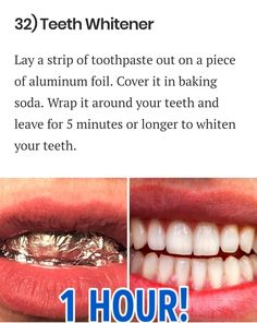 Baking Soda Teeth, Natural Teeth Whitening Diy, Natural Teeth Whitening Remedies, Obličejové Masky, Baking Soda Teeth Whitening, Teeth Whitener