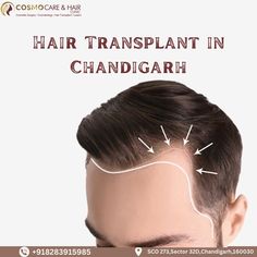 Hair loss can be a challenging experience, affecting not just your appearance but also your self-esteem. In the heart of Chandigarh, Cosmo Care & Hair Clinic stands tall as a beacon of hope, offering advanced and personalized Hair Transplant in Chandigarh that transform lives. For best results regarding Hair Transplant in Chandigarh contact Cosmo Care & Hair Clinic.