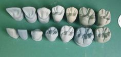 Piezas dentales Teeth Projects For Kids, Teeth Anatomy, Dental Aesthetics, Dental Anatomy, Aesthetic Dentistry, Dental Technician, Dental Facts, Dental Laboratory