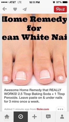 Clean White Nails, Foot Soak, Beauty Remedies, Nail Health, Pedicures, Homemade Beauty Products, Back To Nature, Health And Beauty Tips, Beauty Treatments