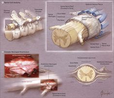 an image of medical diagrams showing the different types of heart valves and their corresponding functions