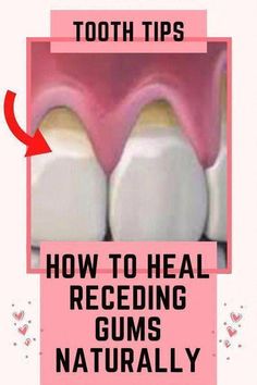 Fix Receding Gums, Tooth Pain Remedies, Grow Back Receding Gums, Tooth Ache Relief, Tooth Decay Remedies, Teeth Health, Stronger Teeth