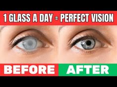 Improve Your Vision with This Delicious Drink—Your Eye Doctor Won't Believe It! - YouTube Nail Health Signs, Eye Health Food, Better Vision, Healthy Natural Hair Growth, Perfect Vision, Eye Sight, Eye Sight Improvement