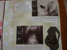 Ultrasound layout--like the image in silhouette. 21 Weeks Pregnant Ultrasound, 8weeks Pregnant Ultrasound, 5 Weeks Pregnant Ultrasound, 4 Weeks Pregnant Ultrasound, First Ultrasound, Ultrasound Pictures, Ultrasound, Memory Scrapbook