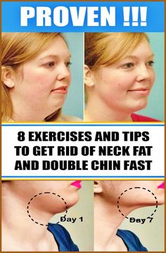 Click here to continue reading: | Neck Fat Exercises, Double Chin Exercises, Chin Exercises, Face Yoga Exercises, Face Yoga Facial Exercises, Facial Yoga, Neck Exercises, Face Exercises, Facial Exercises Neck Fat Exercises, Double Chin Exercises, Chin Exercises, Face Yoga Exercises, Face Yoga Facial Exercises, Neck Exercises, Facial Yoga, Face Exercises, Facial Exercises