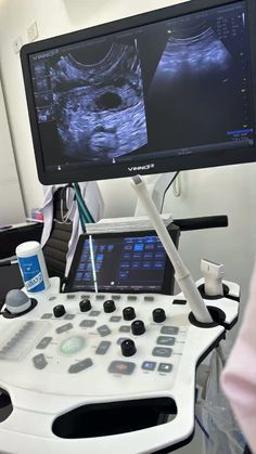 an image of a computer screen and medical equipment