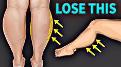 Fat Calves, Slim Calves, Calf Exercises