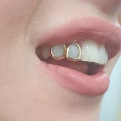 a close up of a person's mouth with two gold rings on top of their teeth