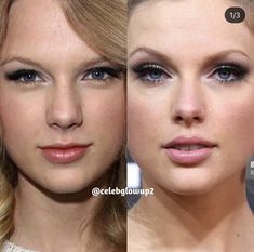 Taylor Swift Before And After, Taylor Swift Nose Job, Sea Before And After Surgery, Celebrities Before And After Surgery, Celebrity Before And After Surgery, Nose Plastic Surgery Before After, Canthoplasty Before And After, Celebrity Before And After, Celebrity Plastic Surgery Before After