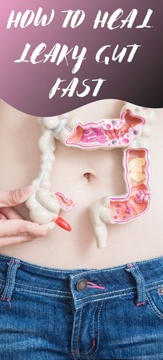 HOW TO HEAL LEAKY GUT FAST;What Heals Leaky Gut? In this article, we will show you some tips and foods that can help you cure this condition. Fix Gut Health, Restore Gut Health, Gut Health Tips, Good Gut Health, Heal Leaky Gut, Probiotic Benefits, Improve Gut Health