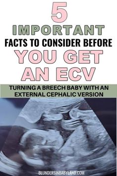 the cover of an article with text that reads, 5 important fact to consider before you get an ecv