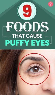 How To Depuff Eyes, Baggy Eyes, Under Eye Puffiness, How To Get Rid Of Pimples, Skin Care Wrinkles, Dark Circles Under Eyes, Beauty Clinic, Face Wrinkles