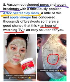 Underground Pimple, The Reality Of Life, Instagram Skincare, Grooming Tips