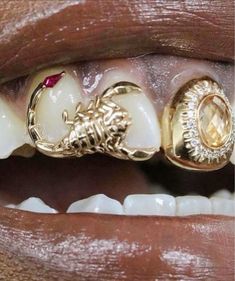 a woman's mouth with gold teeth and braces on top of her teeth