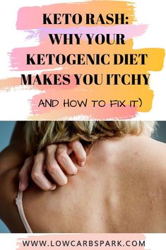 What is Keto Rash? Causes and Treatment Keto Rash, What Is Keto, Rash Causes, Clean Eating Guide, Itchy Rash, Low Carbohydrate Recipes, Life Change, Stomach Ache, High Fat Diet