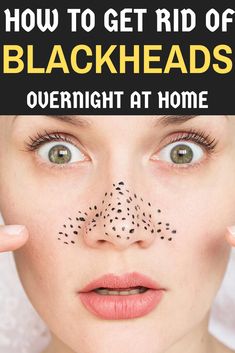 Want to know how to remove blackheads instantly? Yes so here listed natural home remedies, Prevention Tips and tools to get rid of them. Gentle Skin Care Routine, Prevent Pimples, Skin Natural Remedies, Blackhead Removal