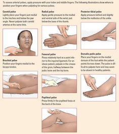 Pulse Points Nursing, Pulses Images, Nursing Information, Nursing Assessment