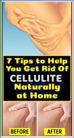 7 Tips To Help You Get Rid Of Cellulite Naturally At Home How To Get Rid Of Leg Cellilute, Creating A Newsletter, Healthy Beauty, Loving Your Body, Apple Cider, Cider, Healthy Life, Scrubs