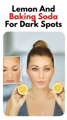 Lemon And Baking Soda, Wrinkle Remedies, Dark Spots On Face, Diy Anti Aging, Spots On Face, Diy Remedies, Saggy Skin, Face Wrinkles, Skin Lightening