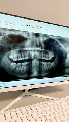 Dental Xrays, Dentist Photography, Future Dentist, Med School Motivation