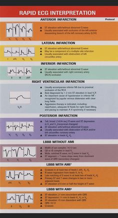 Learn Ekg Cheat Sheets, Cardiac Perfusion Technology, Echocardiography Study, Acls Study Guide 2022, Paramedic Notes, Skills For Resume, Cardiovascular Nursing, Cvicu Nursing