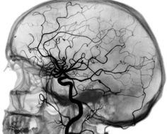 the brain is shown in black and white with an image of a tree growing out of it