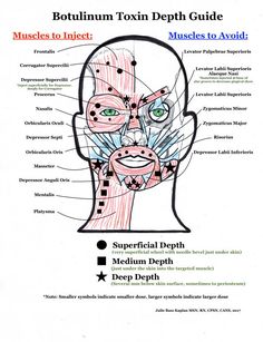 Botox Vs Jeuveau, Starting A Botox Business, Bunny Lines Botox Units, Botox Tips And Tricks, Botox Studio Ideas, Dao Botox Injection, Cosmetic Nurse Injector, Botox Information