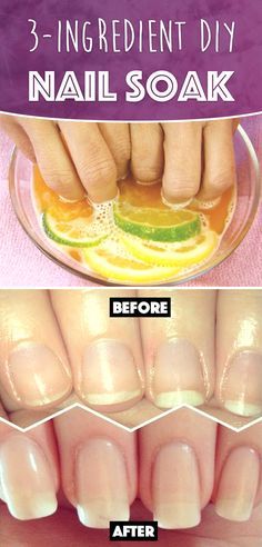 Diy Nail Soak, Nail Growth Remedies, Do It Yourself Nails, Nail Soak, Milky Nails, Best Hair Oil, Nail Care Tips, Simple Health, Brittle Nails