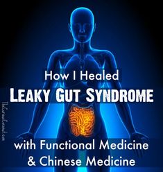 how to heal your gut, gut healing, cleanse, flora, detox, gut, leaky gut, healthy, get rid of, brain, bacteria, challenge, fat, clean program, recipes, diet, foods, health, heal, drinks, supplements, gut healing supplements, vegan, dinner, leaky, kids, detox, gut health, symptoms, facts, restoring, signs, improve, and anxiety, heal, help, meal plan, cure, remedies, gut cleanse, gut detox,  losing weight, simple, nutrition, heal leaky gut, how I healed my leaky gut Leaky Gut Symptoms, Leaky Gut Diet, I Healed, Heal Leaky Gut, Alternative Healing, Gut Healing, Leaky Gut, Thyroid Health, Functional Medicine